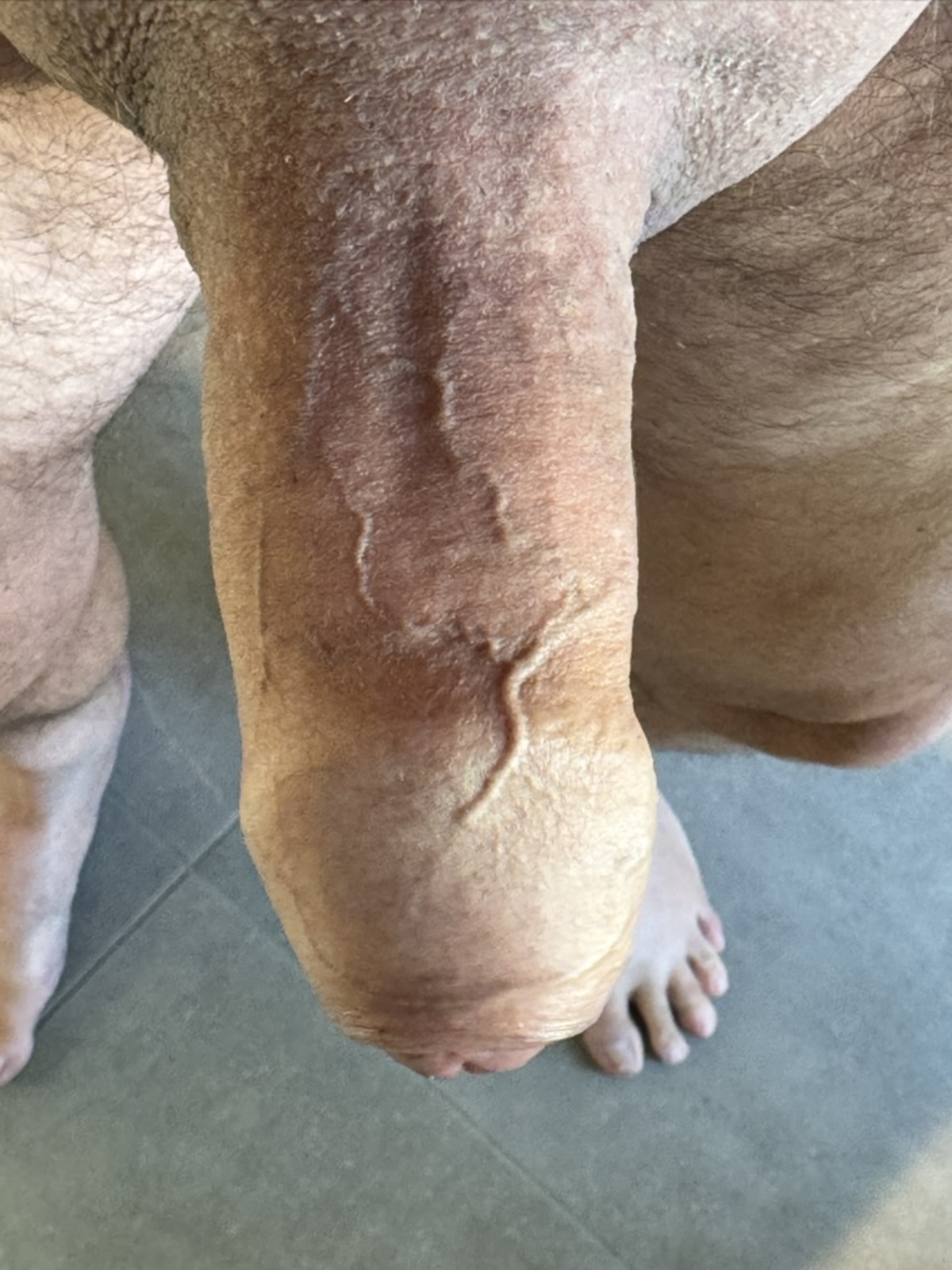Erik